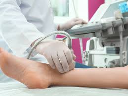 Arteriële Dupleks-Doppler